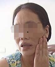 黄鳝血治面瘫的视频,揭秘面瘫治疗新方法